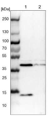 Western Blot: ACADS Antibody [NBP1-89290]