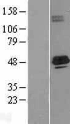 Western Blot: ACADS Overexpression Lysate [NBL1-07221]