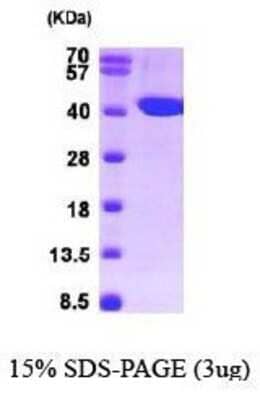 SDS-PAGE: Recombinant Human ACADS His Protein [NBP1-30305]