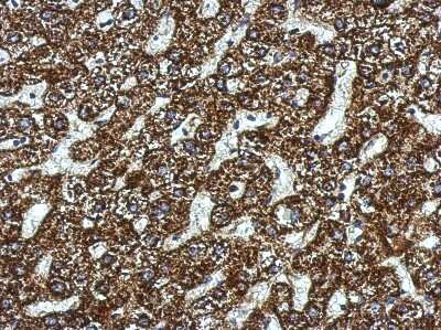 Immunohistochemistry-Paraffin: ACADSB Antibody [NBP2-15237]