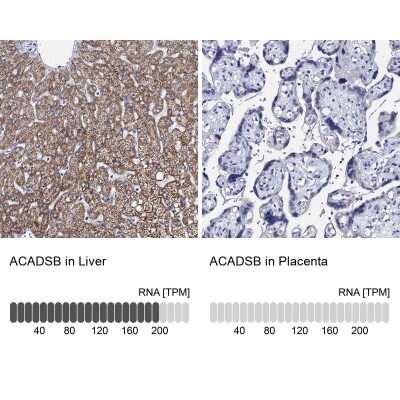 Immunohistochemistry-Paraffin: ACADSB Antibody [NBP2-48739]