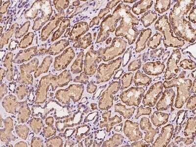 Immunohistochemistry-Paraffin: ACADSB Antibody [NBP2-98594]
