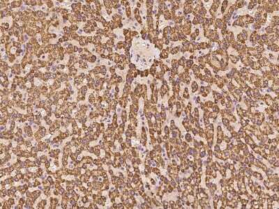 Immunohistochemistry-Paraffin: ACADSB Antibody [NBP2-98594]