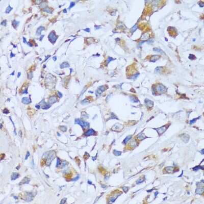 Immunohistochemistry-Paraffin: ACADSB Antibody - Azide and BSA Free [NBP3-04684]
