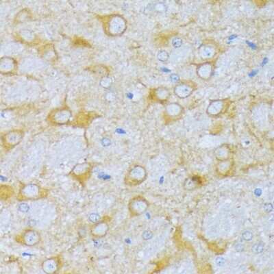Immunohistochemistry-Paraffin: ACADSB Antibody - Azide and BSA Free [NBP3-04684]
