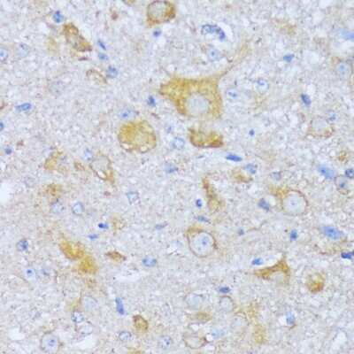 Immunohistochemistry-Paraffin: ACADSB Antibody - Azide and BSA Free [NBP3-04684]