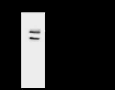 Immunoprecipitation: ACADSB Antibody [NBP2-98594]