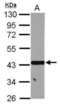 Western Blot: ACADSB Antibody [NBP2-15237]