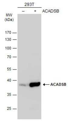 Western Blot: ACADSB Antibody [NBP2-15237]