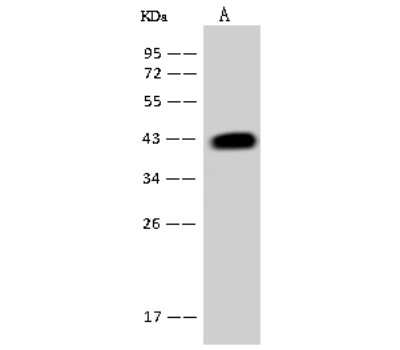 Western Blot: ACADSB Antibody [NBP2-98594]