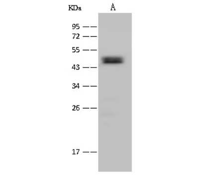 Western Blot: ACADSB Antibody [NBP2-99387]