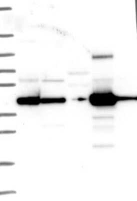 Western Blot: ACADSB Antibody [NBP3-17009]