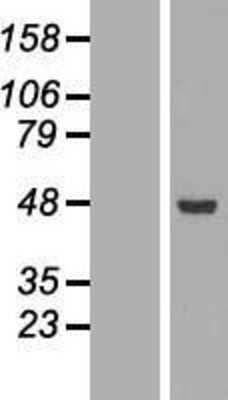 Western Blot: ACADSB Overexpression Lysate [NBL1-07222]