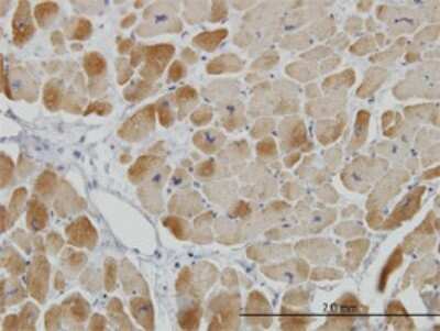 Immunohistochemistry-Paraffin: ACADVL Antibody (5D3) [H00000037-M01]