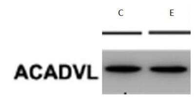 Western Blot: ACADVL Antibody (5D3) [H00000037-M01]