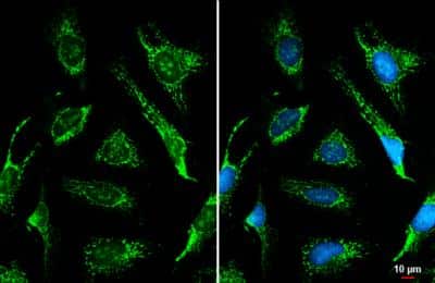 Immunocytochemistry/ Immunofluorescence: ACADVL Antibody [NBP2-15238]