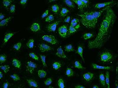 Immunocytochemistry/ Immunofluorescence: ACADVL Antibody [NBP2-97501]