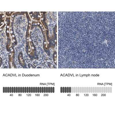 Immunohistochemistry-Paraffin: ACADVL Antibody [NBP1-89286]