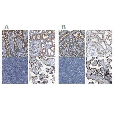 Immunohistochemistry-Paraffin: ACADVL Antibody [NBP1-89286]
