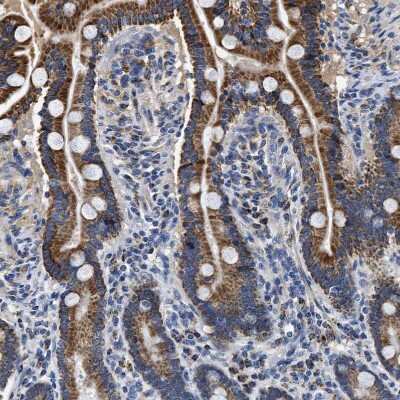 Immunohistochemistry-Paraffin: ACADVL Antibody [NBP1-89286]