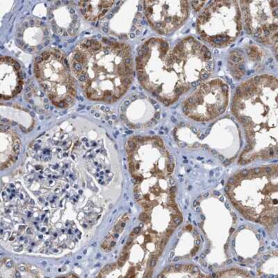 Immunohistochemistry-Paraffin: ACADVL Antibody [NBP1-89286]
