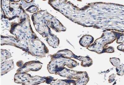 Immunohistochemistry-Paraffin: ACADVL Antibody [NBP1-89286]