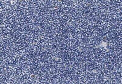 Immunohistochemistry-Paraffin: ACADVL Antibody [NBP1-89286]