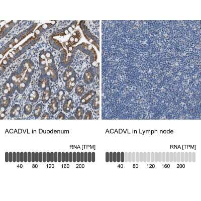 Immunohistochemistry-Paraffin: ACADVL Antibody [NBP1-89287]