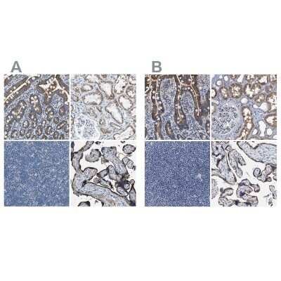 Immunohistochemistry-Paraffin: ACADVL Antibody [NBP1-89287]