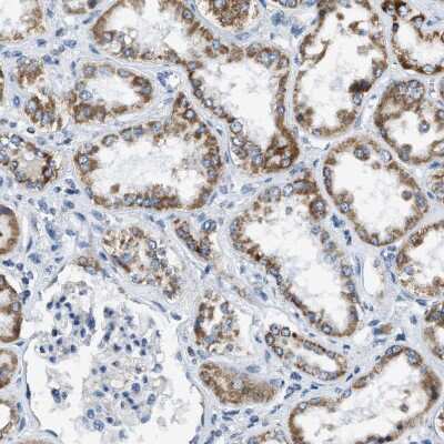 Immunohistochemistry-Paraffin: ACADVL Antibody [NBP1-89287]