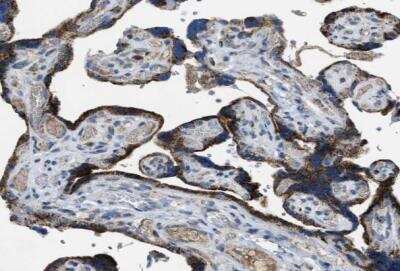 Immunohistochemistry-Paraffin: ACADVL Antibody [NBP1-89287]