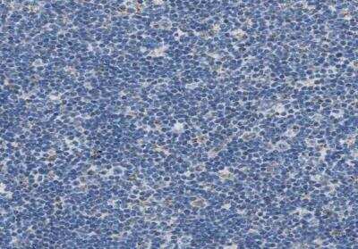 Immunohistochemistry-Paraffin: ACADVL Antibody [NBP1-89287]