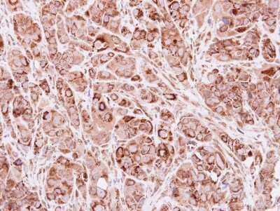Immunohistochemistry-Paraffin: ACADVL Antibody [NBP2-15238]