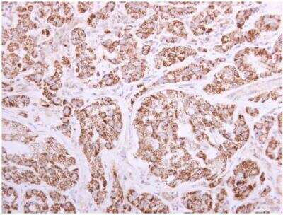 Immunohistochemistry-Paraffin: ACADVL Antibody [NBP2-15238]