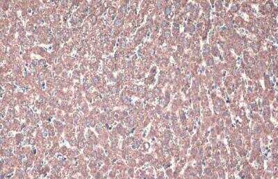 Immunohistochemistry-Paraffin: ACADVL Antibody [NBP2-15238]
