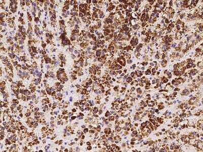 Immunohistochemistry-Paraffin: ACADVL Antibody [NBP2-97501]