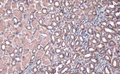 Immunohistochemistry-Paraffin: ACADVL Antibody [NBP2-15238]