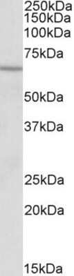 Western Blot: ACADVL Antibody [NBP1-52016]