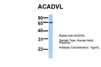 Western Blot: ACADVL Antibody [NBP1-54378]