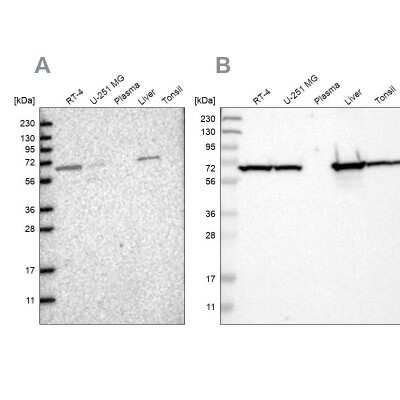 Western Blot: ACADVL Antibody [NBP1-89286]