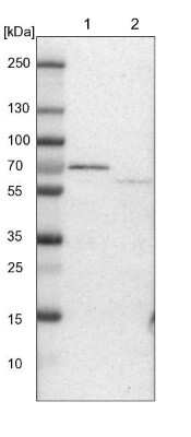 Western Blot: ACADVL Antibody [NBP1-89287]