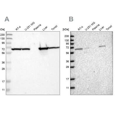 Western Blot: ACADVL Antibody [NBP1-89287]