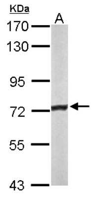 Western Blot: ACADVL Antibody [NBP2-15238]