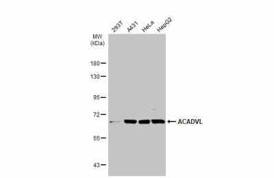 Western Blot: ACADVL Antibody [NBP2-15238]