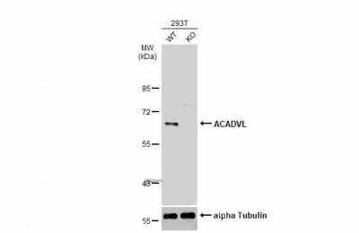Western Blot: ACADVL Antibody [NBP2-15238]