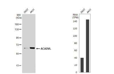 Western Blot: ACADVL Antibody [NBP2-15238]