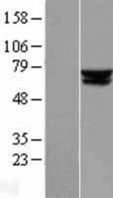 Western Blot: ACADVL Overexpression Lysate [NBL1-07223]