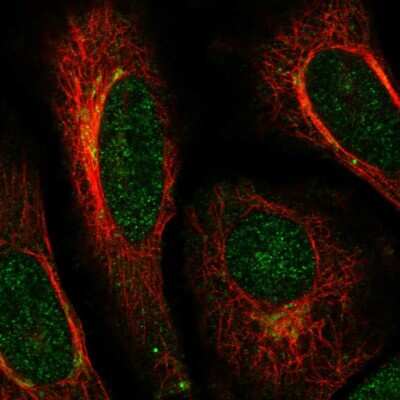 Immunocytochemistry/ Immunofluorescence: ACAP3 Antibody [NBP2-58434]