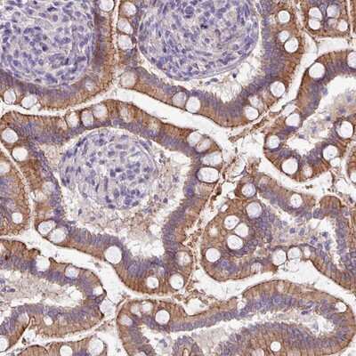 Immunohistochemistry-Paraffin: ACAP3 Antibody [NBP2-14257]