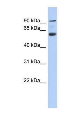 Western Blot: ACAP3 Antibody [NBP1-70400]